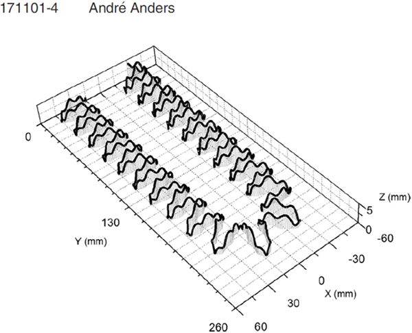 Electron Drift Patterns